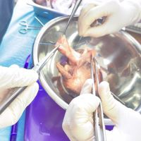 Metodă inovativă în formarea medicilor-rezidenți în cardiochirurgie